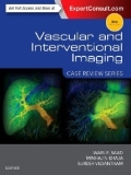 Isbn# is : 1455776300