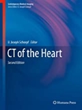 Isbn# is : 1603272364