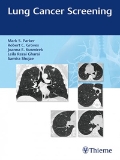 Isbn# is : 1626235139