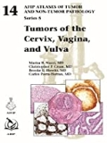 Isbn# is : 1933477261
