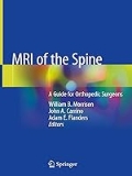 Isbn# is : 3030436268