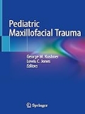Isbn# is : 3030530914