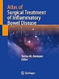 Isbn# is : 3031624300